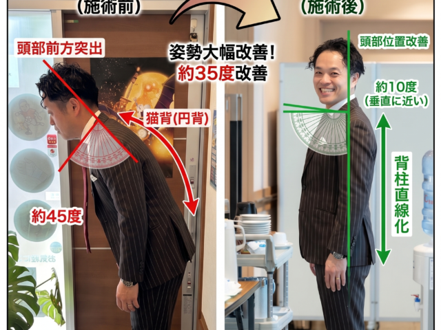 第一印象力up！！で売り上げもアップ⁉　猫背で背中が伸びなかった悩みを大亀谷しみず接骨院のカイロプラクティックでスッキリ♪